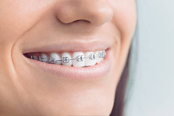 Best Wisdom Tooth Removal  in Melwood, MD